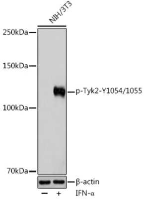 Western Blot: Tyk2 [p Tyr1055, p Tyr1054] AntibodyBSA Free [NBP3-16896]